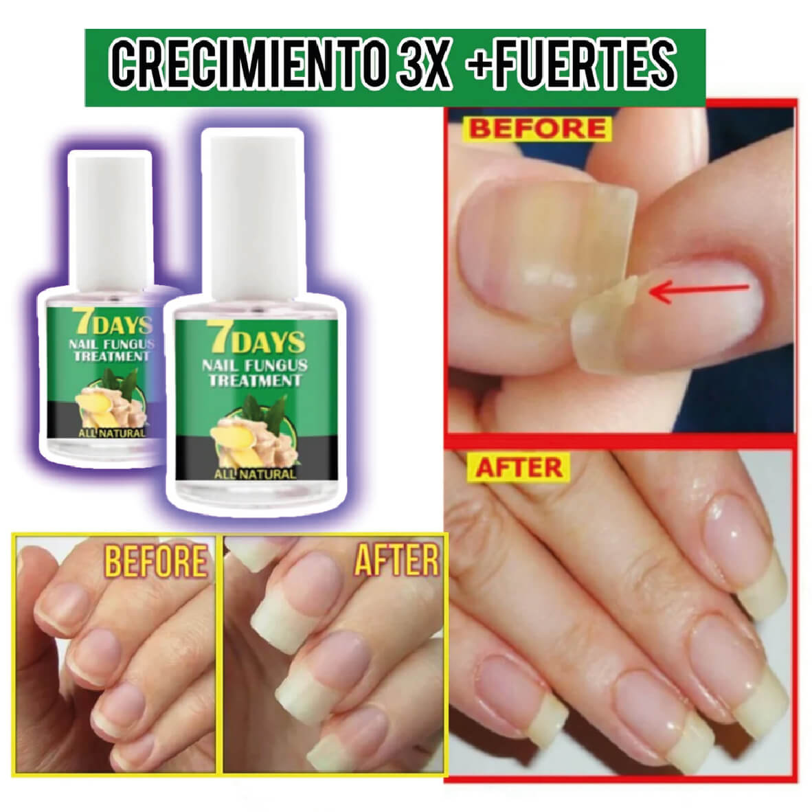 Serum para uñas